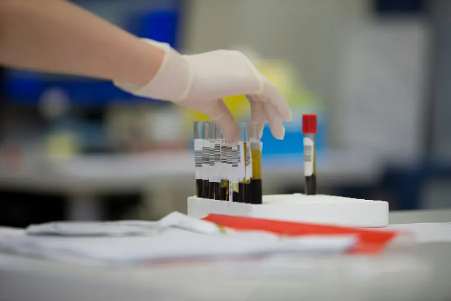 Perfiles completos en Laboratorio Clínico Vital, Pitalito (foto de muestra)