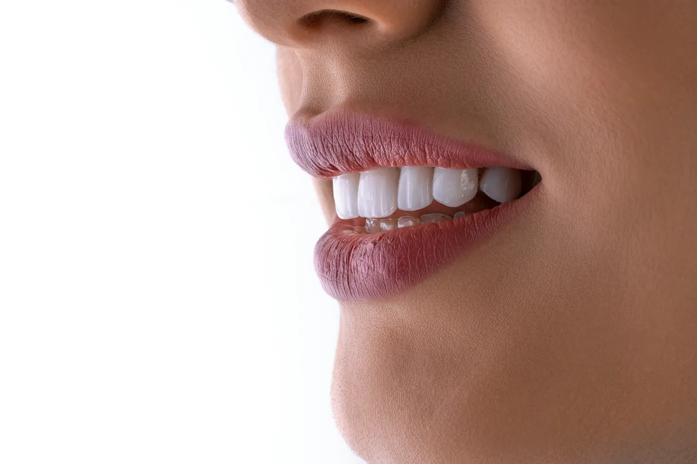 un primer plano de la boca de una mujer con dientes blancos