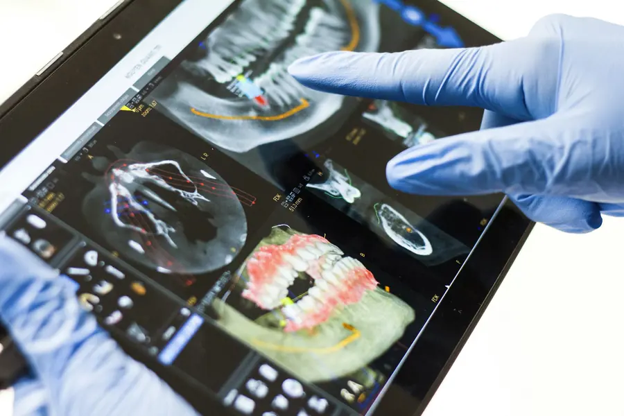 Implantes en Sonríe Odontología, Pitalito (foto de muestra)