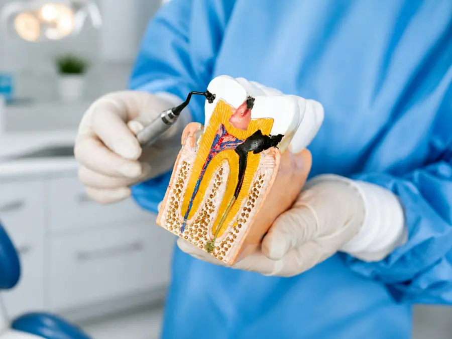 Limpieza y blanqueamiento en Sonríe Odontología, Pitalito (foto de muestra)